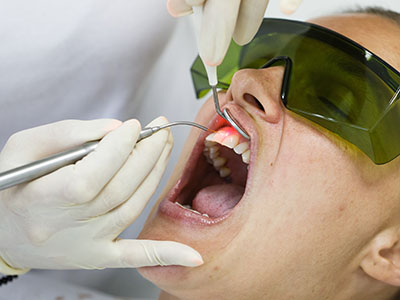 Milestones Children   Family Dentistry | Root Canals, Crowns  amp  Caps and Dental Fillings